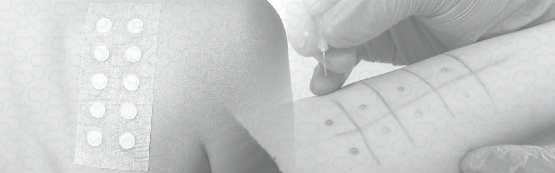 Curso de Prick Test e Patch Test para Médicos
