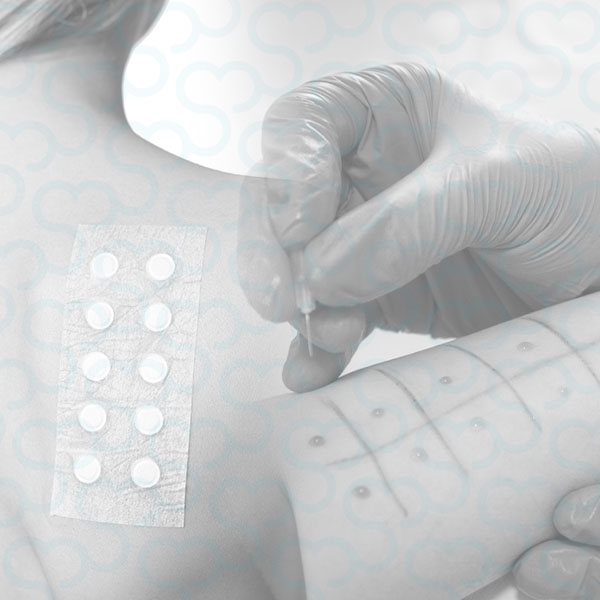 Curso de Prick Test e Patch Test para Médicos